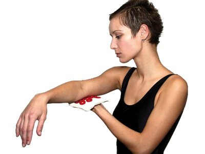  |  | B6 – Iplikator local d’acupression